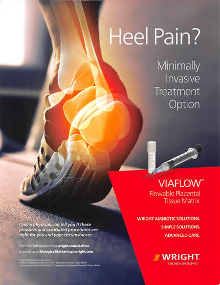 Heel pain clearance treatment medicine